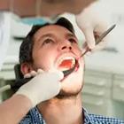 Una persona en el dentista con la boca abierta