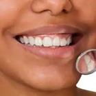 Sonrisa de la mujer y los dientes